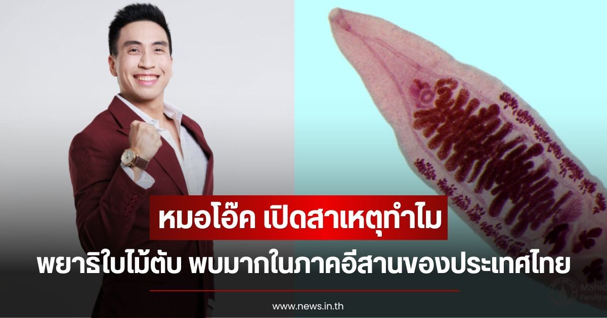 หมอโอ๊ค เปิดสาเหตุทำไม พยาธิใบไม้ตับ พบมากในภาคอีสานของประเทศไทย พร้อมเผยสิ่งที่น่ากลัวที่สุดหลังเป็น