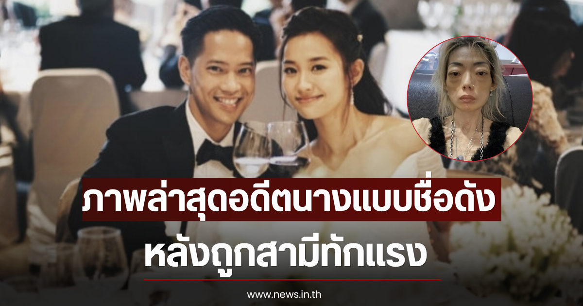 แฟนๆตกใจ ภาพล่าสุดอดีตนางแบบชื่อดัง หลังถูกสามีทักแรง (ตปท)