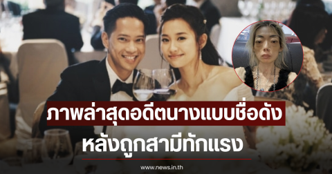 แฟนๆตกใจ ภาพล่าสุดอดีตนางแบบชื่อดัง หลังถูกสามีทักแรง (ตปท)