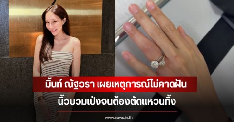 มิ้นท์ ณัฐวรา เผยเหตุการณ์ไม่คาดฝัน นิ้วบวมเป่งจนต้องตัดเเหวนทิ้ง