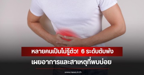 หลายคนเป็นไม่รู้ตัว!  6 ระดับตับพัง เผยอาการและสาเหตุที่พบบ่อย