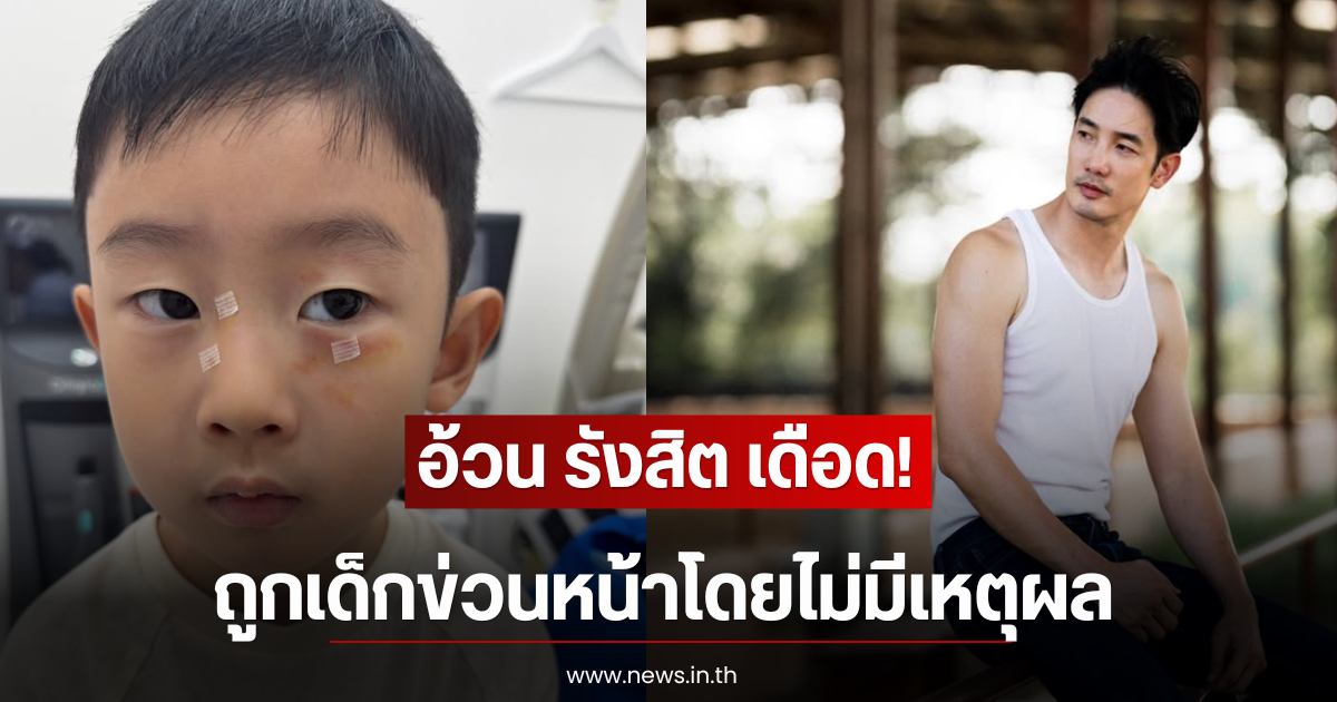อ้วน รังสิต เดือด! น้องโรฮา ถูกเด็กข่วนหน้าโดยไม่มีเหตุผล
