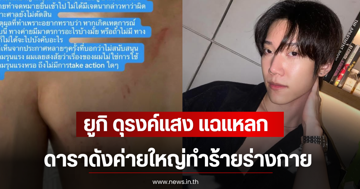 สะเทือนวงการ! ยูกิ ดุรงค์แสง แฉแหลก ดาราดังค่ายใหญ่ทำร้ายร่างกายหลังคบหา 1 ปี