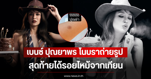 เบนซ์ ปุณยาพร โนบราถ่ายรูปในวันเกิด สุดท้ายได้รอยไหม้จากเทียน