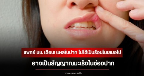 แพทย์ มช. เตือน! แผลในปาก ไม่ได้เป็นร้อนในเสมอไป อาจเป็นสัญญาณมะเร็งในช่องปาก
