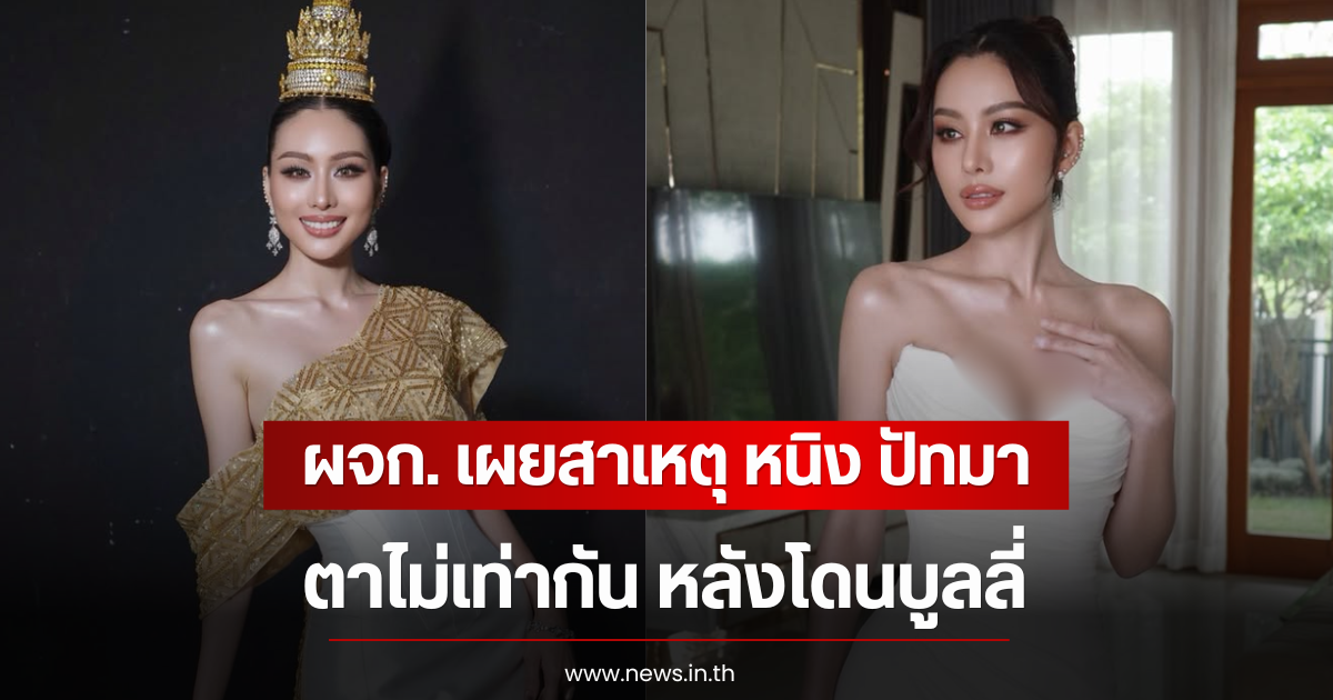 ผจก. เผยสาเหตุ หนิง ปัทมา ตาไม่เท่ากัน หลังโดนบูลลี่