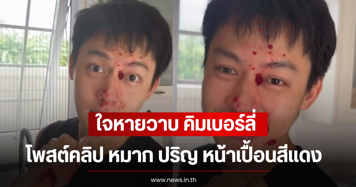 ใจหายวาบ คิมเบอร์ลี่ โพสต์คลิป หมาก ปริญ หน้าเปื้อนสีแดง