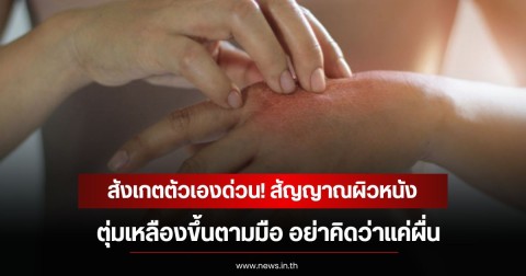 สังเกตตัวเองด่วน! สัญญาณผิวหนังตุ่มเหลืองขึ้นตามมือ อย่าคิดว่าแค่ผื่น