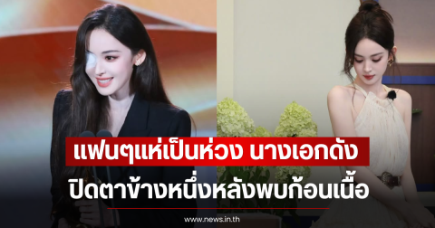 แฟนๆแห่เป็นห่วง นางเอกดัง ปิดตาข้างหนึ่งหลังพบก้อนเนื้อ (ตปท)