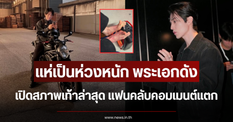 แห่เป็นห่วงหนัก พระเอกดัง เปิดสภาพเท้าล่าสุด แฟนคลับคอมเมนต์แตก (ข่าวต่างประเทศ)