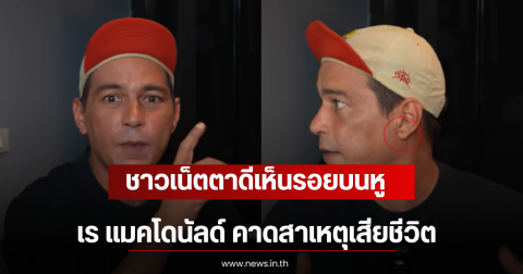 ภาพไวรัล! หลังชาวเน็ตตาดีเห็นรอยบนหู เร แมคโดนัลด์ คาดสาเหตุเสียชีวิต
