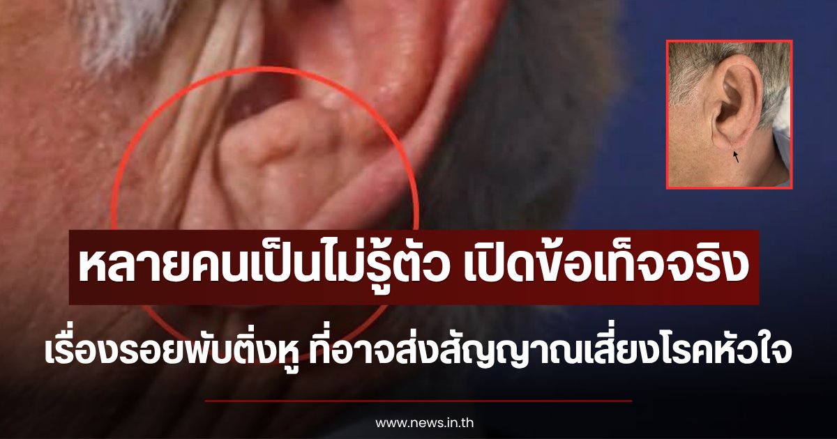 หลายคนเป็นไม่รู้ตัว เปิดข้อเท็จจริง เรื่องรอยพับติ่งหู ที่อาจส่งสัญญาณเสี่ยงโรคหัวใจ