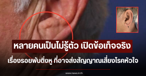 หลายคนเป็นไม่รู้ตัว เปิดข้อเท็จจริง เรื่องรอยพับติ่งหู ที่อาจส่งสัญญาณเสี่ยงโรคหัวใจ