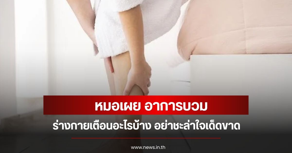 หมอเผย อาการบวม ร่างกายเตือนอะไรบ้าง อย่าชะล่าใจเด็ดขาด