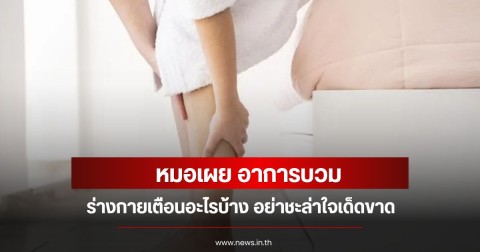 หมอเผย อาการบวม ร่างกายเตือนอะไรบ้าง อย่าชะล่าใจเด็ดขาด