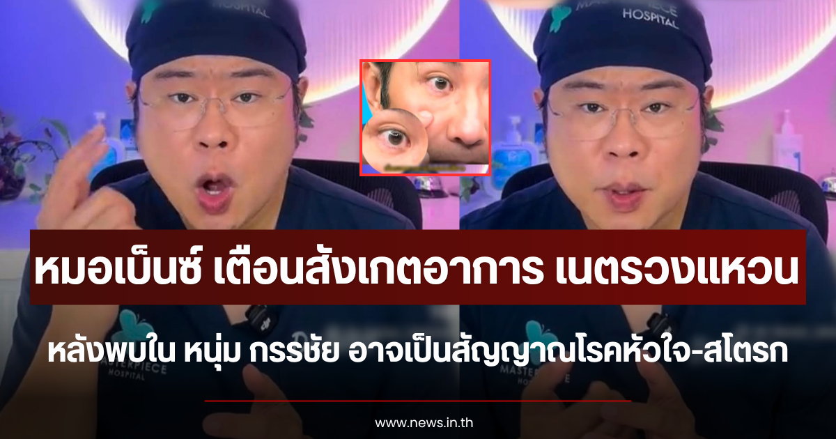 หมอเบ็นซ์ เตือนสังเกตอาการ เนตรวงแหวน หลังพบใน หนุ่ม กรรชัย อาจเป็นสัญญาณโรคหัวใจ-สโตรก