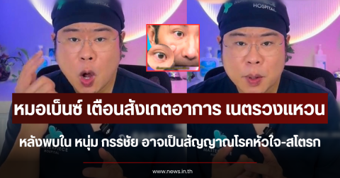 หมอเบ็นซ์ เตือนสังเกตอาการ เนตรวงแหวน หลังพบใน หนุ่ม กรรชัย อาจเป็นสัญญาณโรคหัวใจ-สโตรก