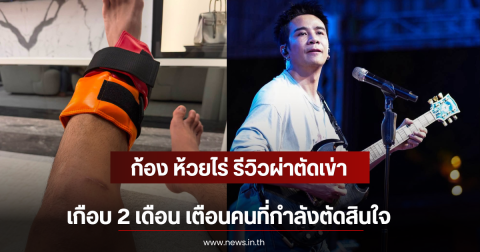 ก้อง ห้วยไร่ รีวิวผ่าตัดเข่าเกือบ 2 เดือน เตือนคนที่กำลังตัดสินใจ