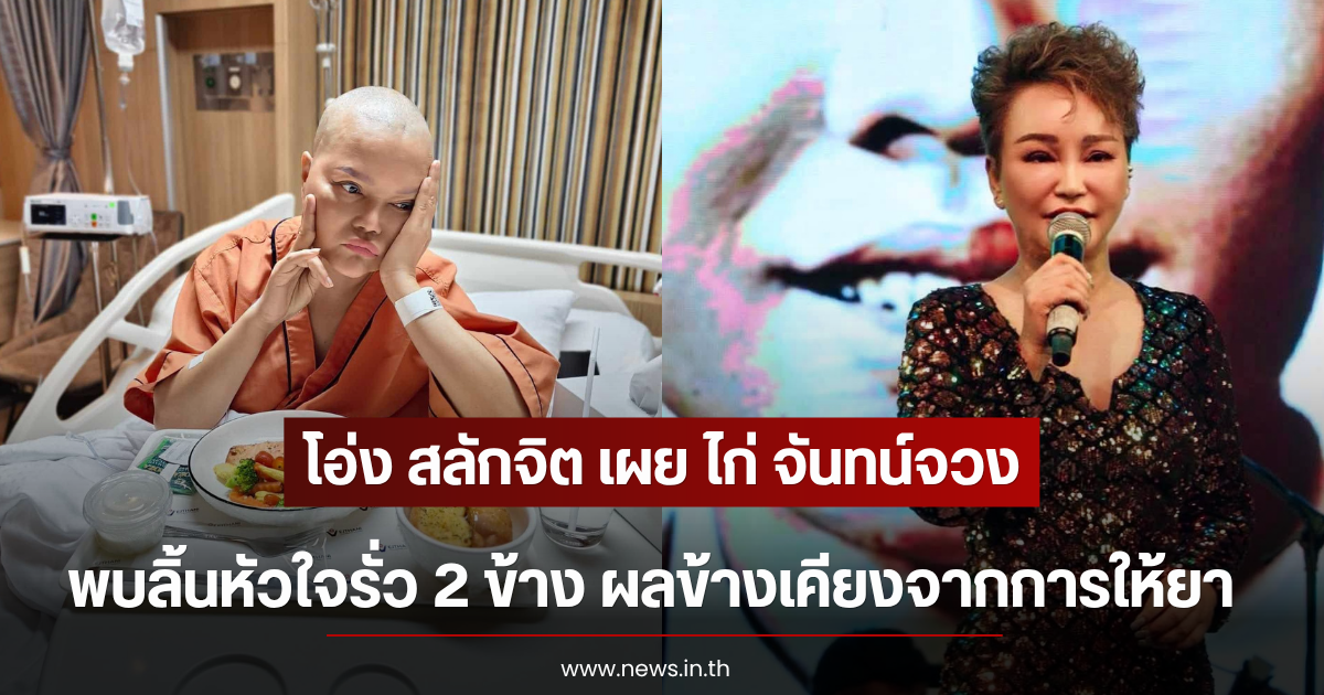 โอ่ง สลักจิต เผย ไก่ จันทน์จวง พบลิ้นหัวใจรั่ว 2 ข้าง ผลข้างเคียงจากการให้ยา