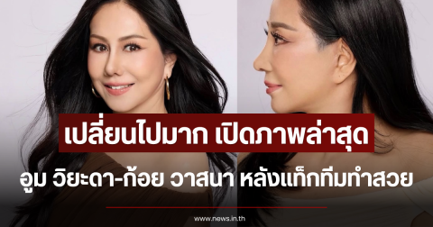 เปลี่ยนไปมาก เปิดภาพล่าสุด อูม วิยะดา-ก้อย วาสนา หลังทำสวย