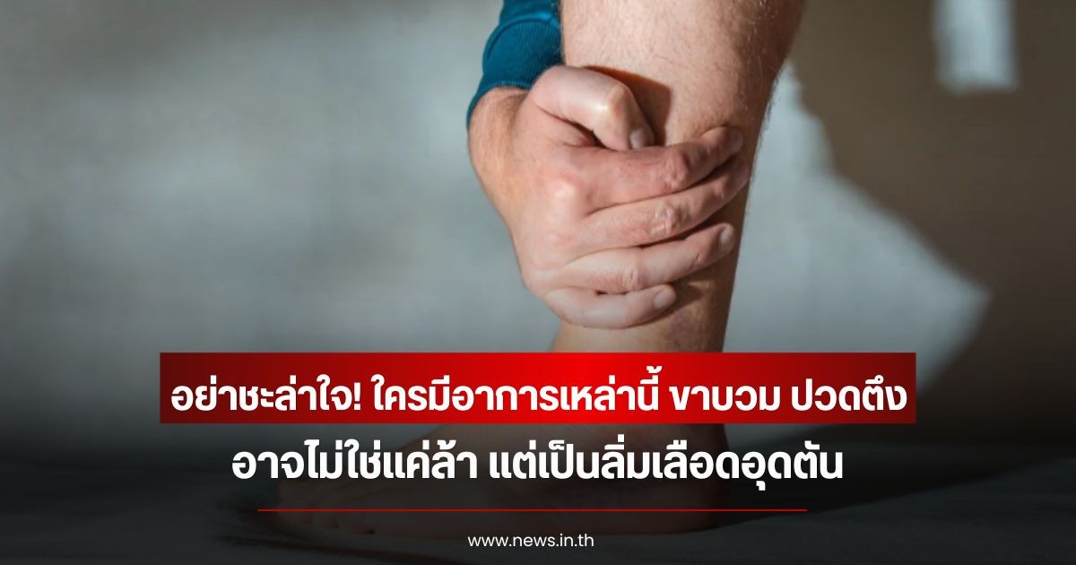 อย่าชะล่าใจ! ใครมีอาการเหล่านี้ ขาบวม ปวดตึง อาจไม่ใช่แค่ล้า แต่เป็นลิ่มเลือดอุดตัน