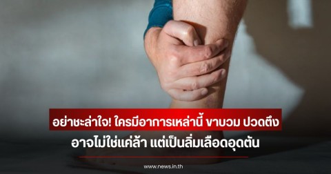 อย่าชะล่าใจ! ใครมีอาการเหล่านี้ ขาบวม ปวดตึง อาจไม่ใช่แค่ล้า แต่เป็นลิ่มเลือดอุดตัน