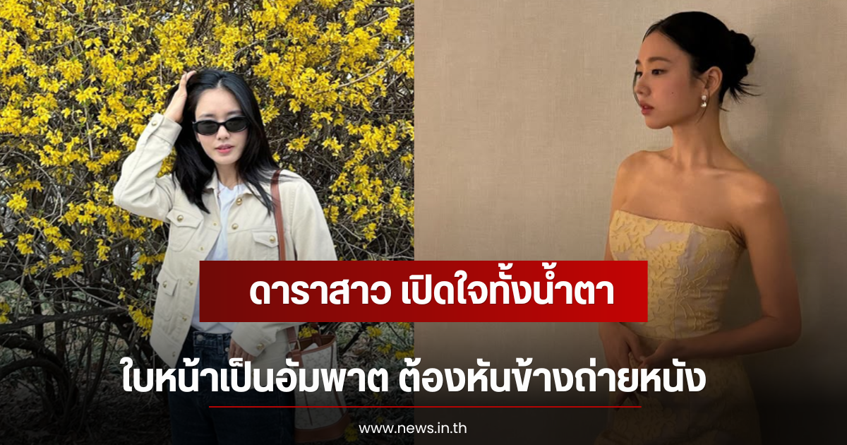 ดาราสาว เปิดใจทั้งน้ำตา ใบหน้าเป็นอัมพาต ต้องหันข้างถ่ายหนัง (ตปท)