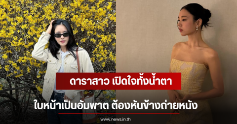 ดาราสาว เปิดใจทั้งน้ำตา ใบหน้าเป็นอัมพาต ต้องหันข้างถ่ายหนัง (ตปท)