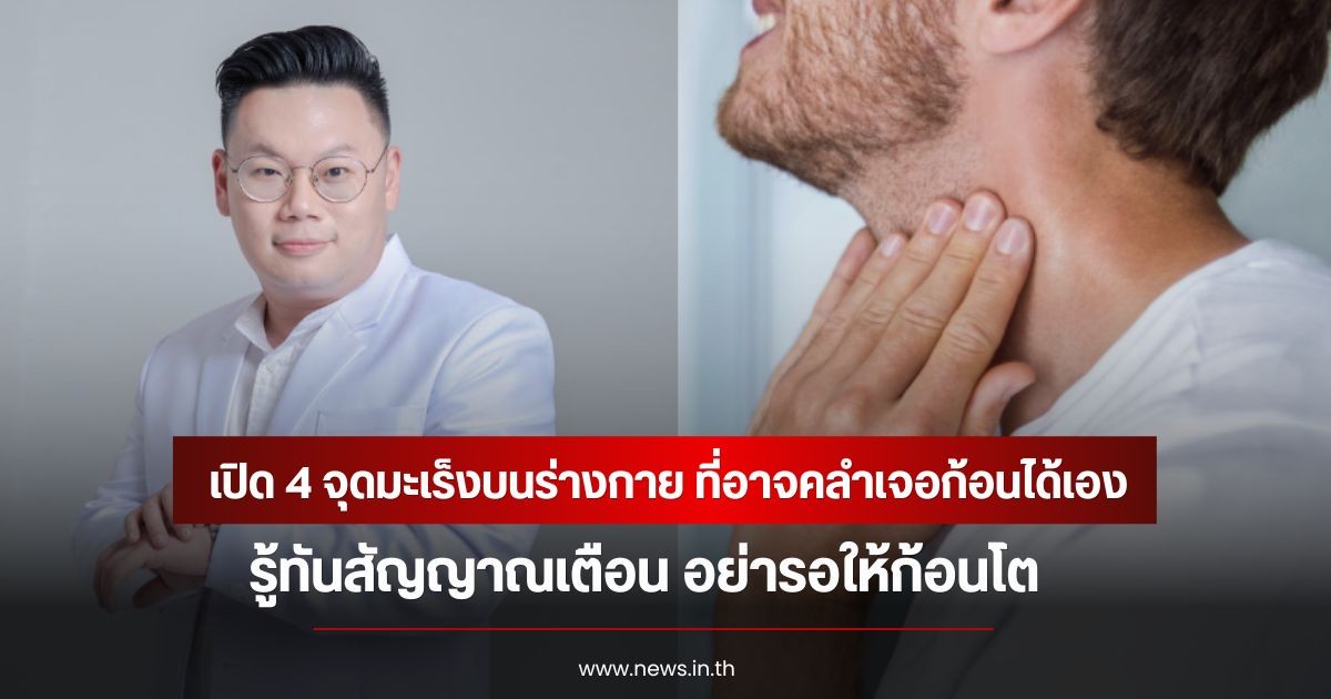 หมอเจด เปิด 4 จุดมะเร็งบนร่างกาย ที่อาจคลำเจอก้อนได้เอง รู้ทันสัญญาณเตือน อย่ารอให้ก้อนโต