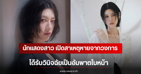 แฟนๆช็อก นักแสดงสาว เปิดสาเหตุหายจากวงการ ได้รับวินิจฉัยเป็นอัมพาตใบหน้า (ตปท)