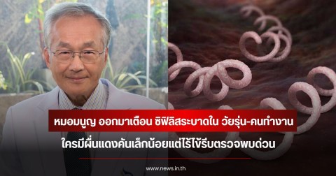 หมอมนูญ ออกมาเตือน ซิฟิลิสระบาดใน วัยรุ่น-คนทำงาน ใครมีผื่นแดงคันเล็กน้อยแต่ไร้ไข้รีบตรวจพบด่วน