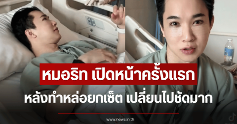 หมอริท เปิดหน้าครั้งแรก หลังทำหล่อยกเซ็ต เปลี่ยนไปชัดมาก