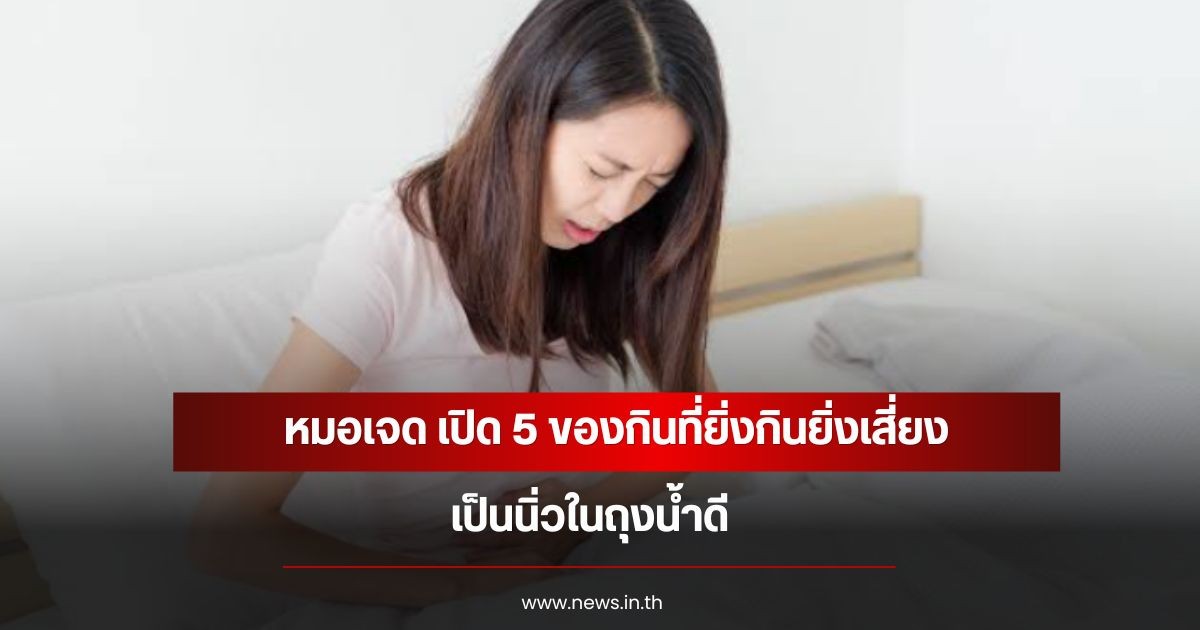 หมอเจด เปิด 5 ของกินที่ยิ่งกินยิ่งเสี่ยง เป็นนิ่วในถุงน้ำดี