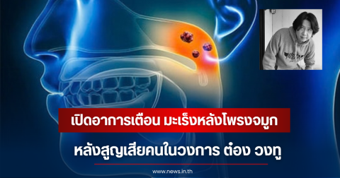 เปิดอาการเตือน มะเร็งหลังโพรงจมูก หลังวงการสูญเสีย ต๋อง วงทู