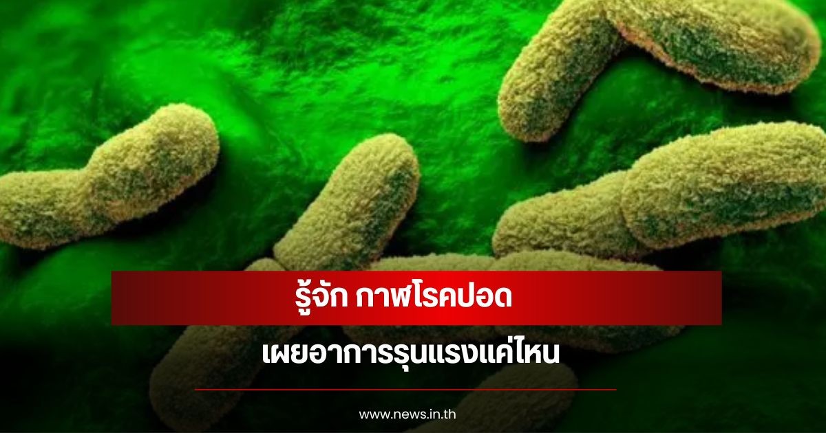 รู้จัก กาฬโรคปอด เผยอาการรุนแรงแค่ไหน