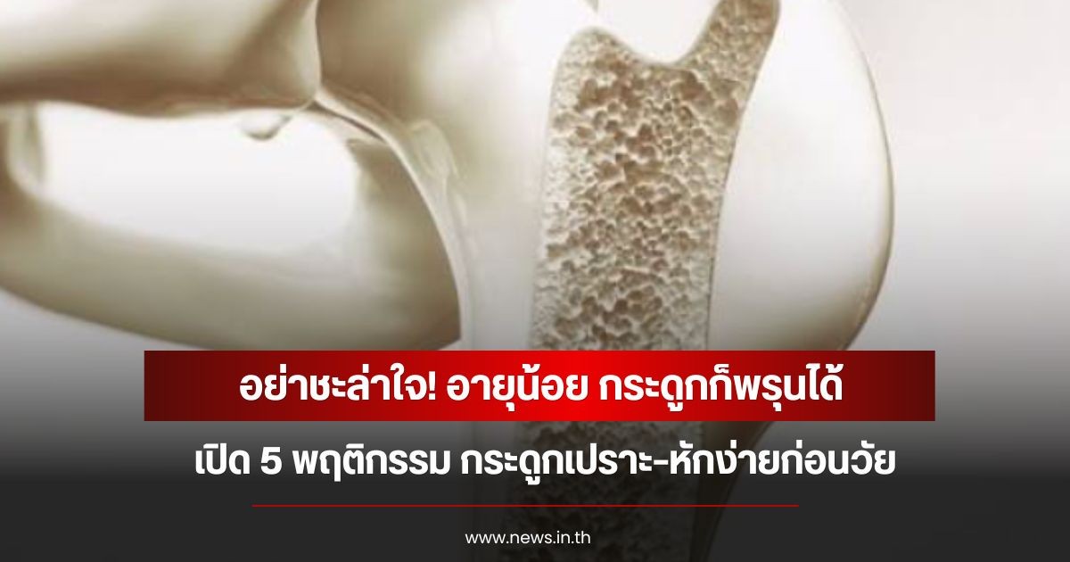 อย่าชะล่าใจ! อายุน้อย กระดูกก็พรุนได้ เปิด 5 พฤติกรรม กระดูกเปราะ–หักง่ายก่อนวัย
