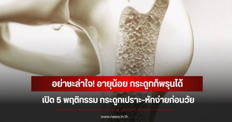 อย่าชะล่าใจ! อายุน้อย กระดูกก็พรุนได้ เปิด 5 พฤติกรรม กระดูกเปราะ–หักง่ายก่อนวัย